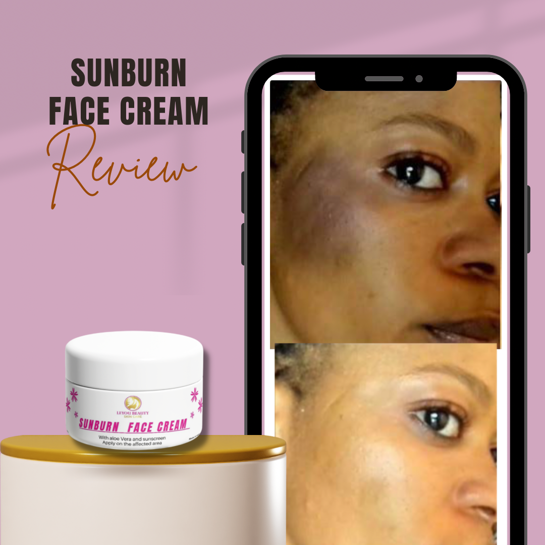 Sunburn face cream ( dark spot corrector ) 20 g
